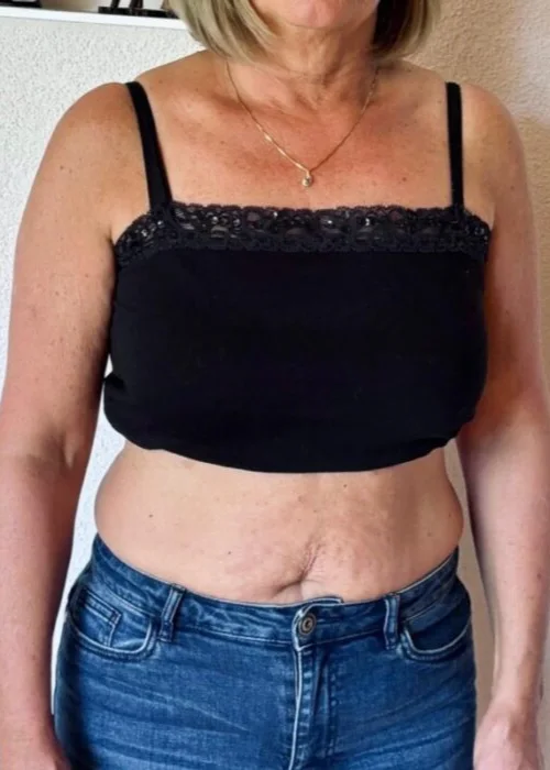 Vorher